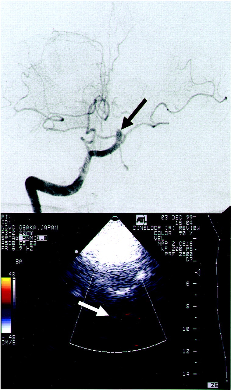 Fig 2.