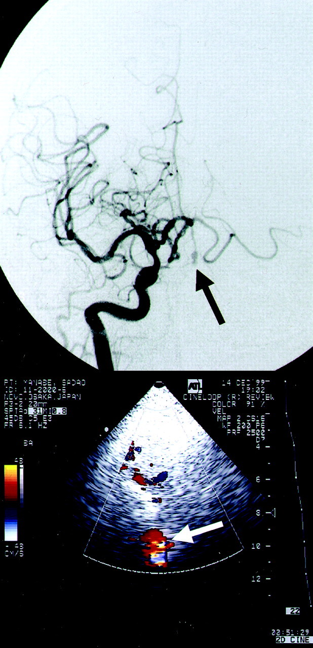 Fig 1.