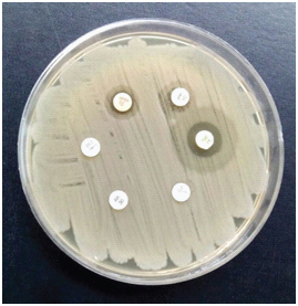 [Table/Fig-1]: