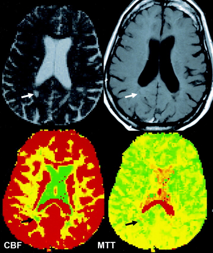 Fig 3.