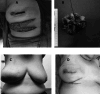 Fig. 3