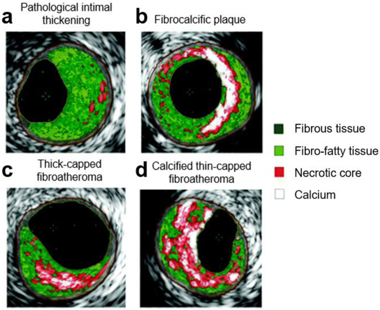 Fig. 3