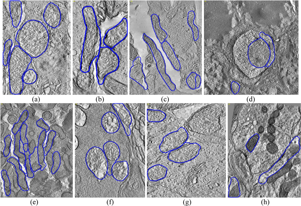 Fig. 13