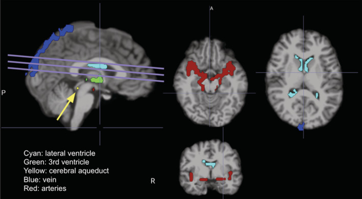 FIGURE 1