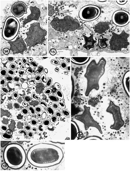 Fig. 14–18