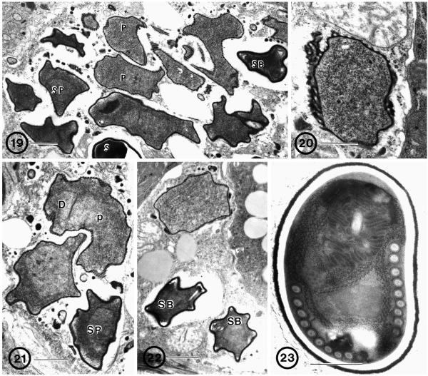 Fig. 19–23