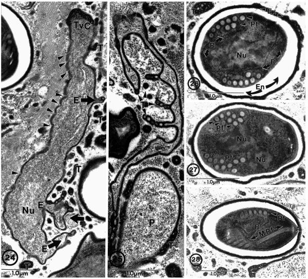 Fig. 24–28