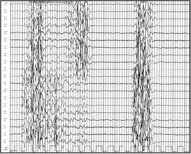 Fig. (1)