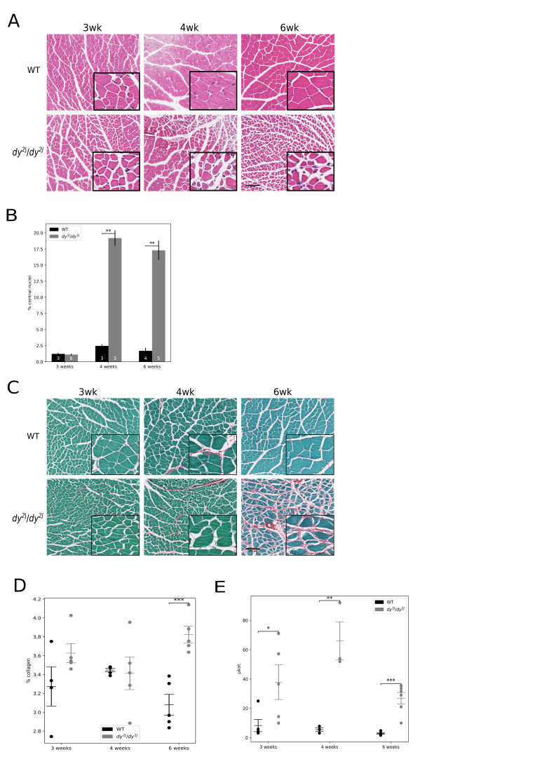 Fig3. Progressive muscle deterioration and collagen accumulation as evidenced by histology and CK concentration. A: Haematoxylin and eosin staining; B: Central nucleation quantification (as percentage of fibres with central nuclei); C: Fast green/sirius red staining: collagen is coloured red; D: Quantification of collagen as percentage of total protein; E: CK. Scale bars = 100 μm; * p < 0.05, ** p < 0.01, *** p < 0.001.