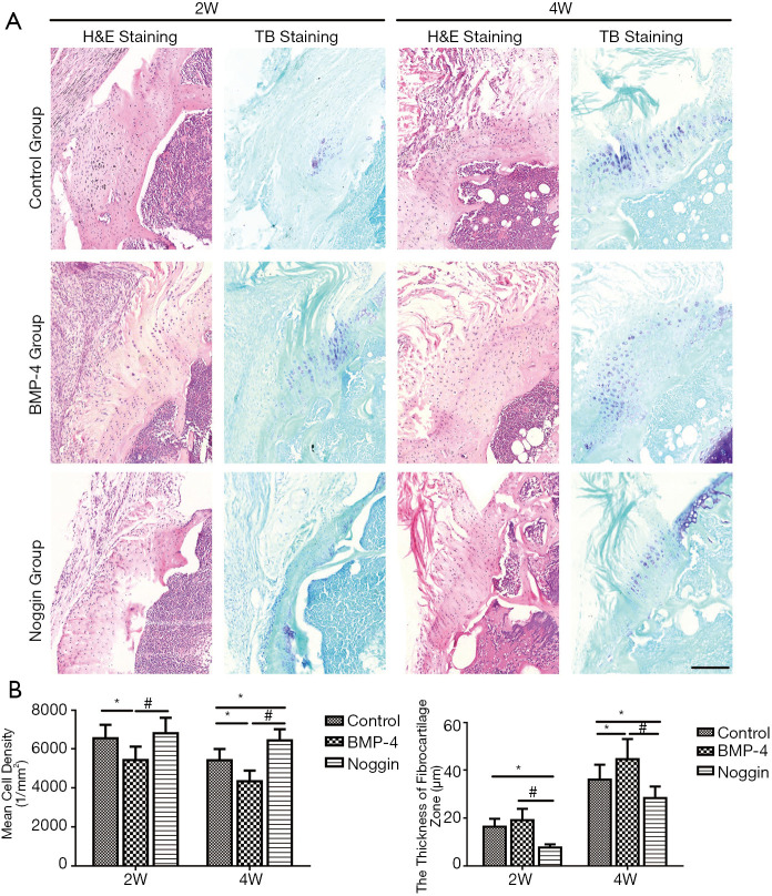 Recombinant human bone morphogenetic protein-4 enhances tendon-to-bone ...