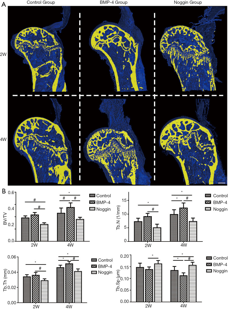 Recombinant human bone morphogenetic protein-4 enhances tendon-to-bone ...