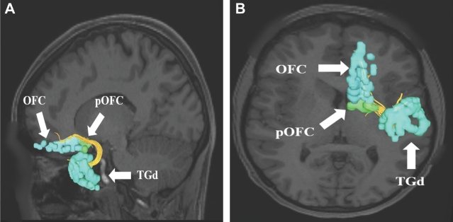 FIGURE 3.