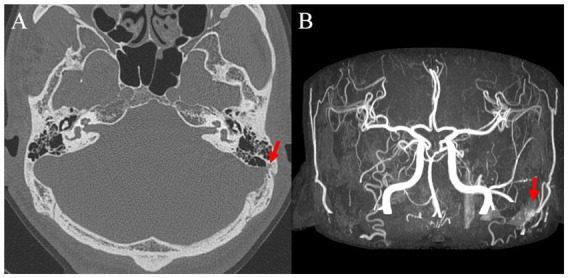 Figure 6