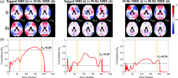 Example “between-group” comparisons of 2D Cartesian strain tensor fields for different experiment types: tagged MRI versus 10 Hz MRE; tagged MRI versus 50 Hz MRE; and 10 Hz MRE versus 50 Hz MRE. (a) Normalized strain fields in a single midaxial slice. Components are ordered εxx, εyy, and εxy starting from left to right. Rows (i) and (ii) correspond to experiment type. (b) Plots of each slice-by-slice correlation value versus axial slice number.
