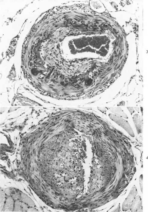 Fig. 3-4