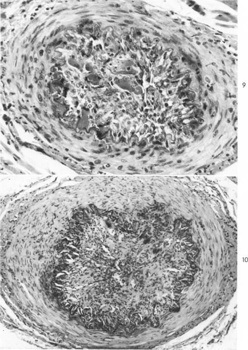 Fig. 9-10