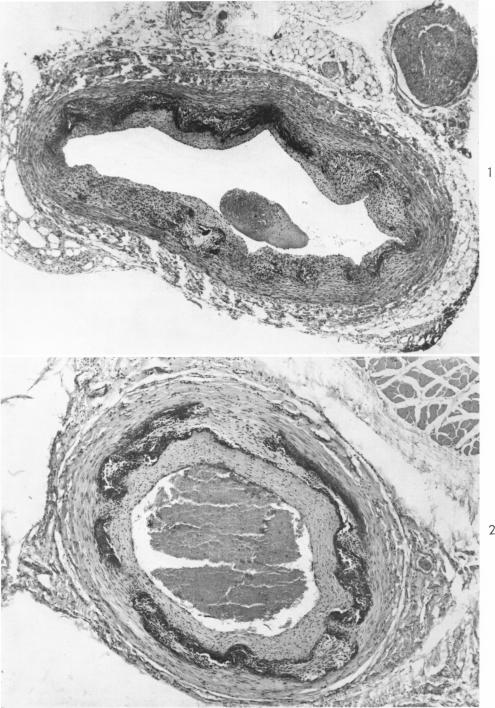 Fig. 1-2