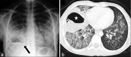 Figure 13