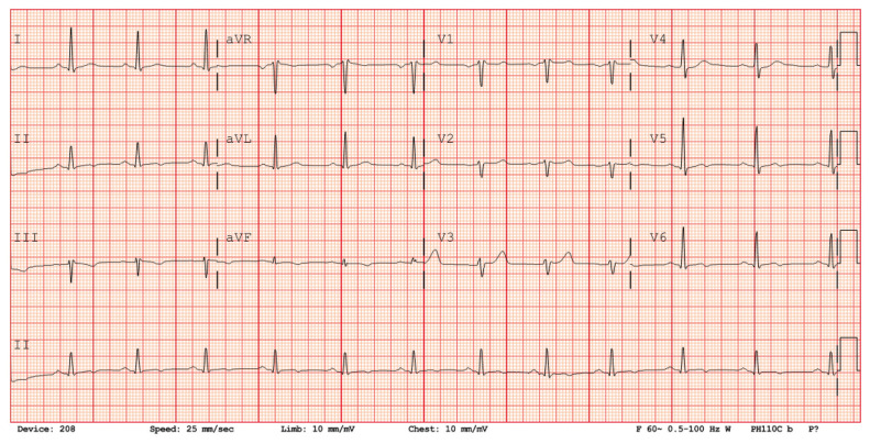 Figure 1: