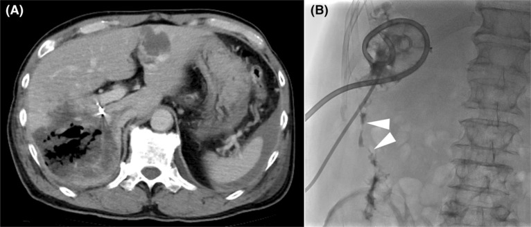 FIGURE 2