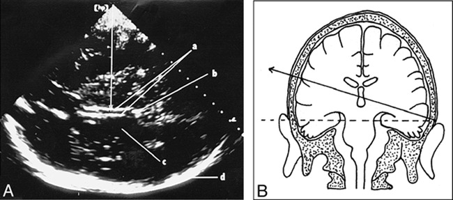 fig 1.