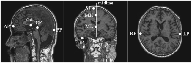 Fig. 2