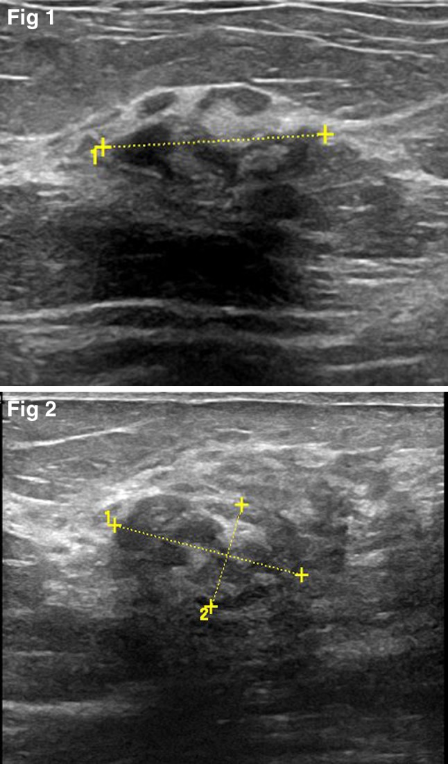 Fig. 1–2