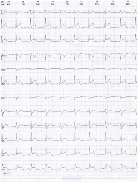 Fig. 11