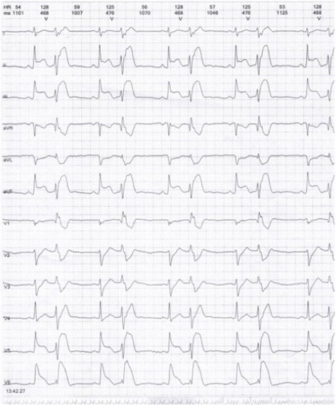 Fig. 13