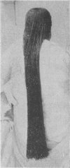 115