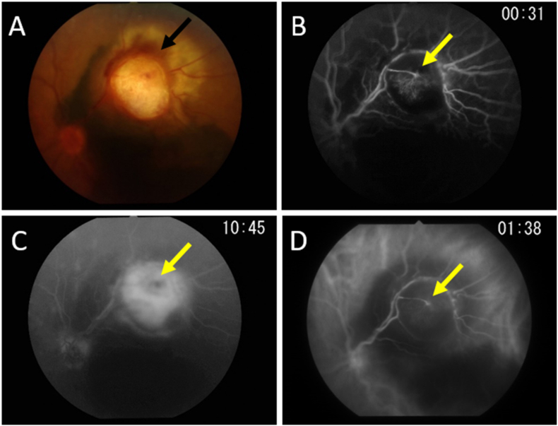 Fig. 2