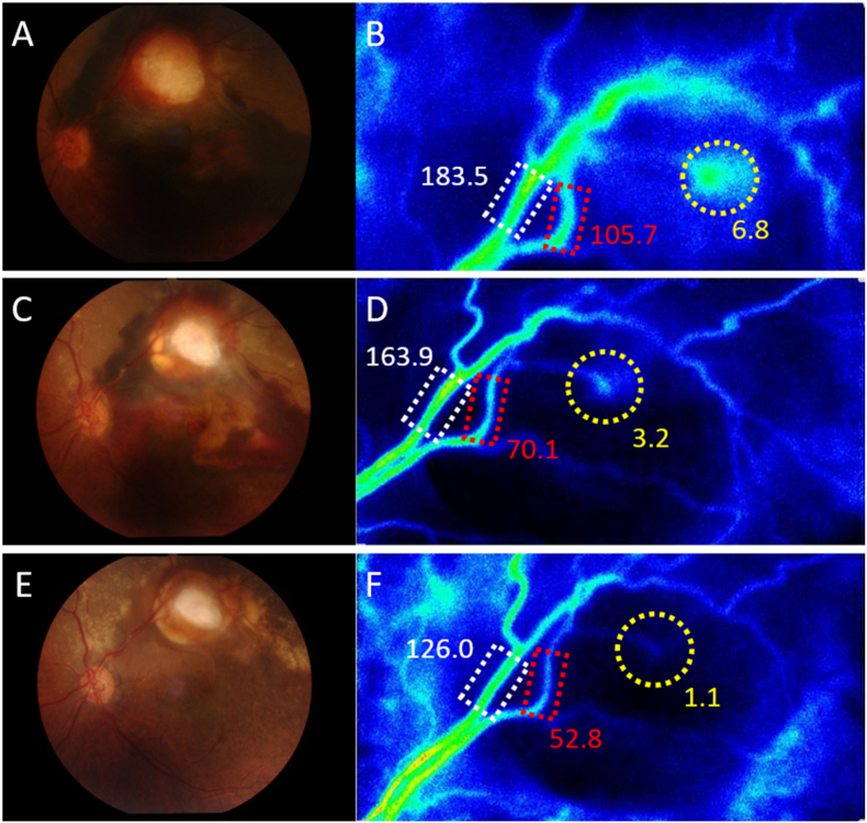 Fig. 3