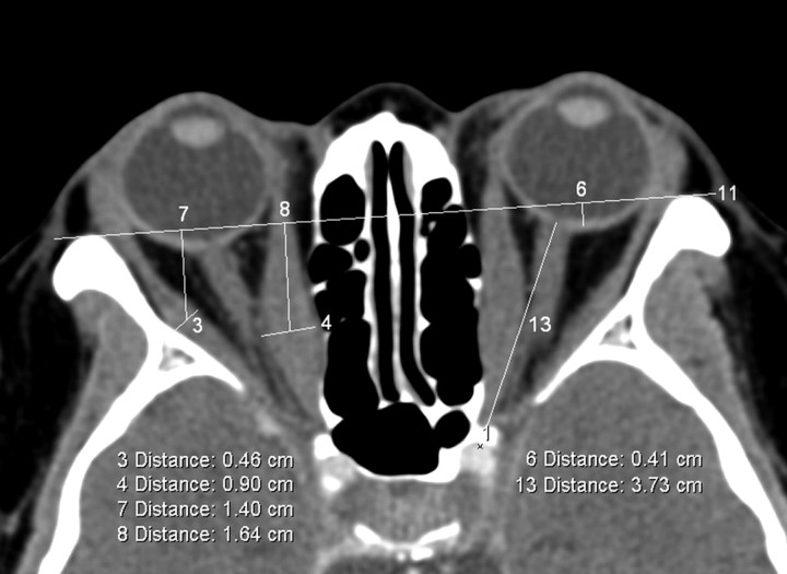 Fig 2.