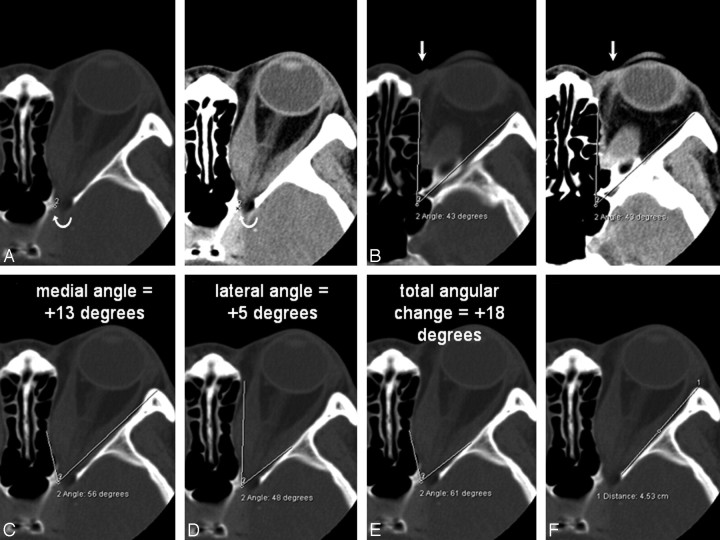 Fig 1.