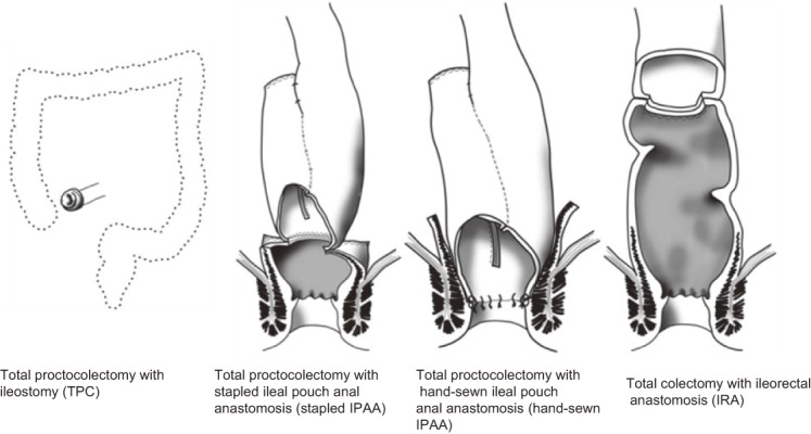 Figure 11.