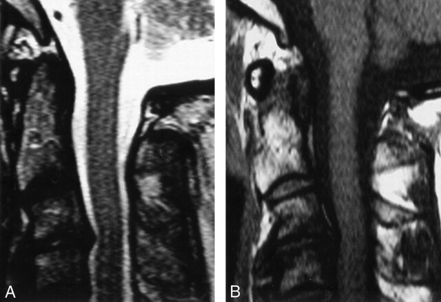 Fig 2.