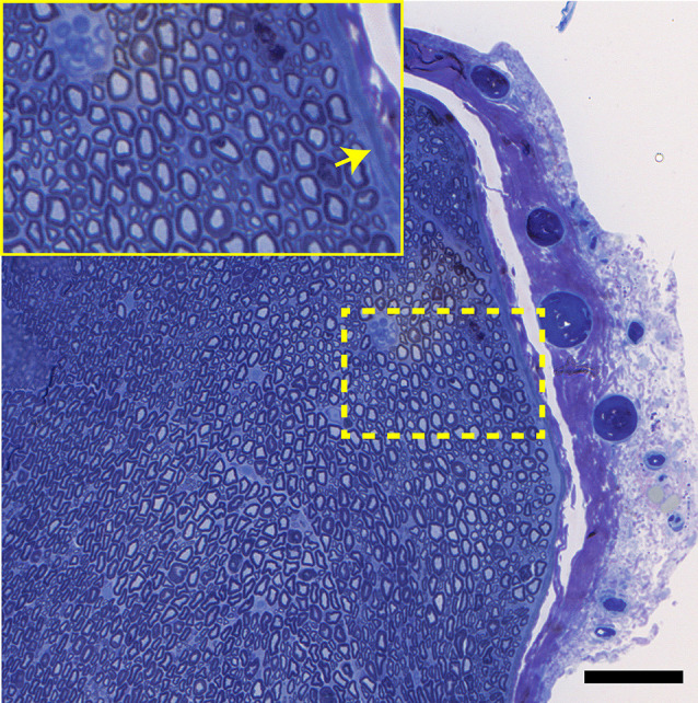 Figure 13