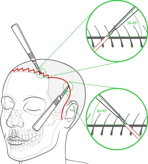 Figure 14