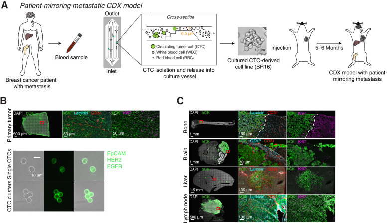 Figure 1. Generation and characterization of a CTC-derived xenograft model. A, Schematic of the establishment of human CTC-derived xenografts (CDX) from a patient with breast cancer (BR16). CTCs from BR16 patient blood were isolated, expanded ex vivo, and injected in the mammary fat pad of NSG mice. Upon tumor development, spontaneously formed CTCs seed metastases to defined organs, mirroring the metastatic pattern of the patient-of-origin. B, Representative pictures of primary tumor, single CTCs, and CTC clusters from the BR16-CDX model. The primary tumor was stained for human pan-cytokeratin (hCK; green), laminin (turquoise), CD31 (red), Ki67 (purple), and DAPI (nuclei; white), whereas single CTCs and CTC clusters were live-stained for epithelial cell adhesion molecule (EpCAM), HER2, and EGFR (green) within the microfluidic cassette, directly after capture. C, Representative pictures of spontaneous bone, brain, liver and lymph node metastasis of BR16-CDX mice, stained for hCK (green), laminin (turquoise), glial fibrillary acidic protein (GFAP; turquoise), CD31 (red), Ki67 (purple), and DAPI (white).