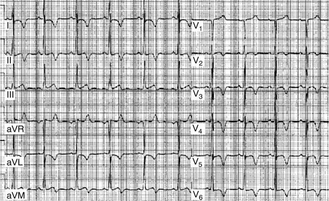 Figure 1  