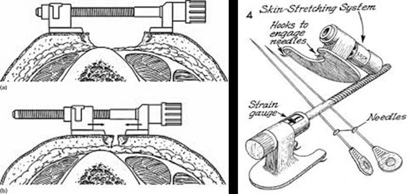 Fig. 5