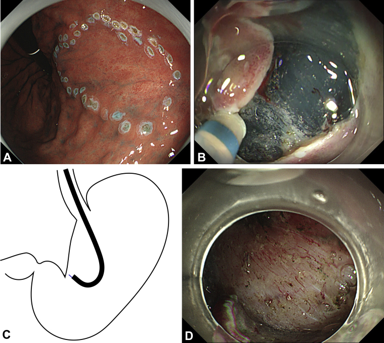 Figure 2