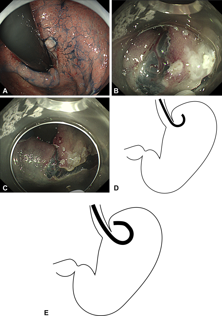 Figure 3