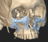 graphic file with name 41598_2023_39327_Figj_HTML.gif
