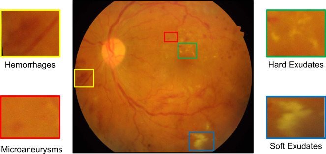 Fig. 1