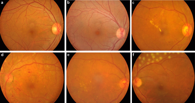 Fig. 3