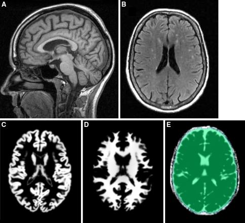 Fig. 1