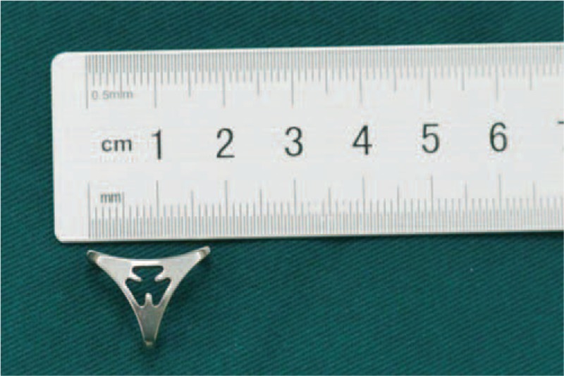 FIGURE 1