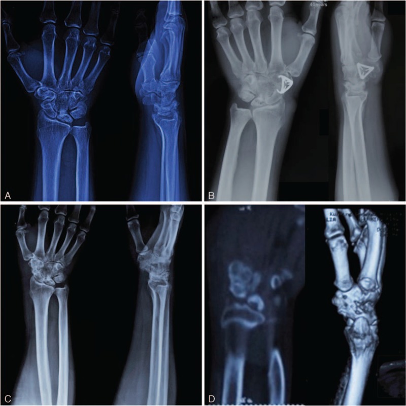 FIGURE 3
