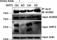 Figure 1—figure supplement 5.